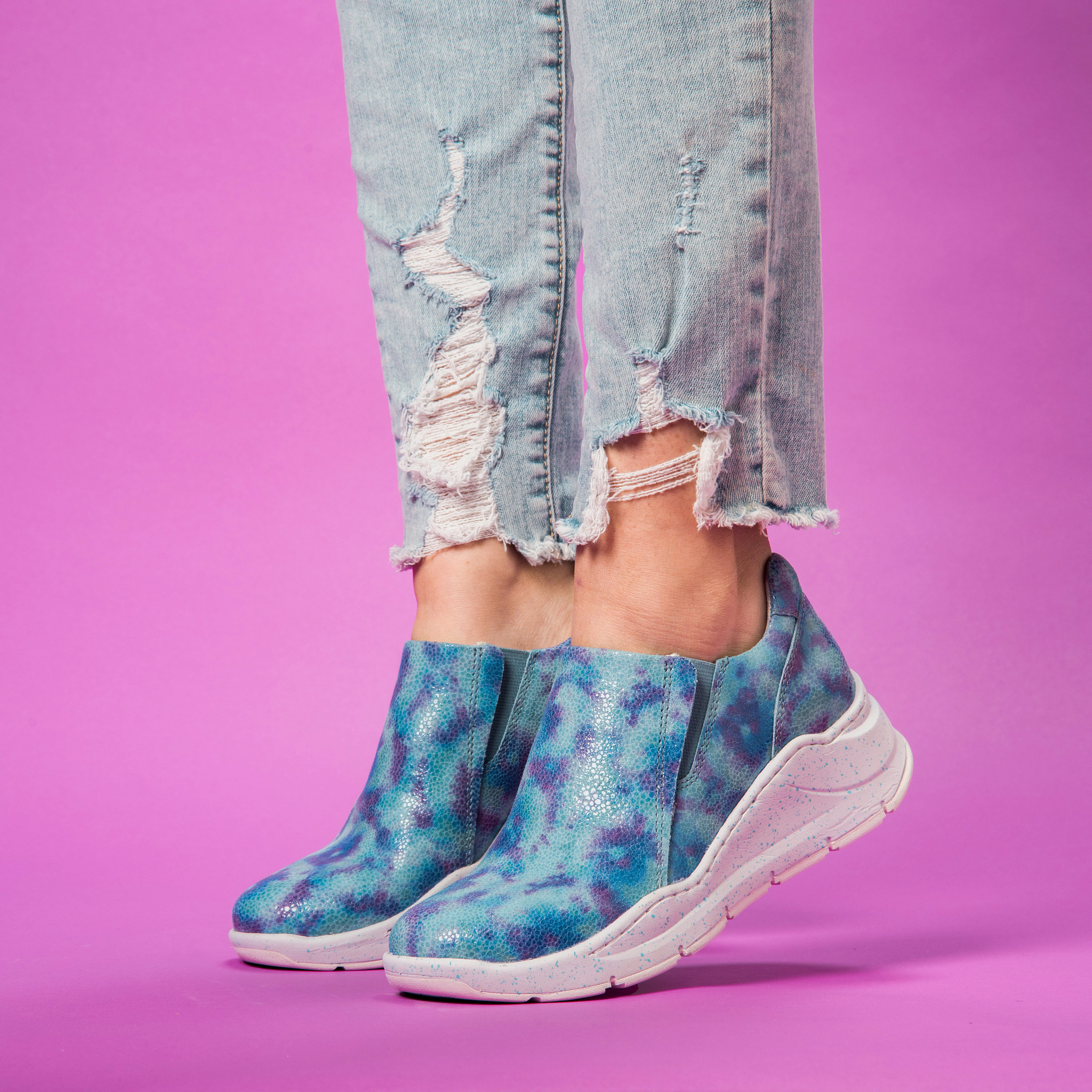 Align&trade; Luna shown on model 